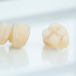 Dental Crowns